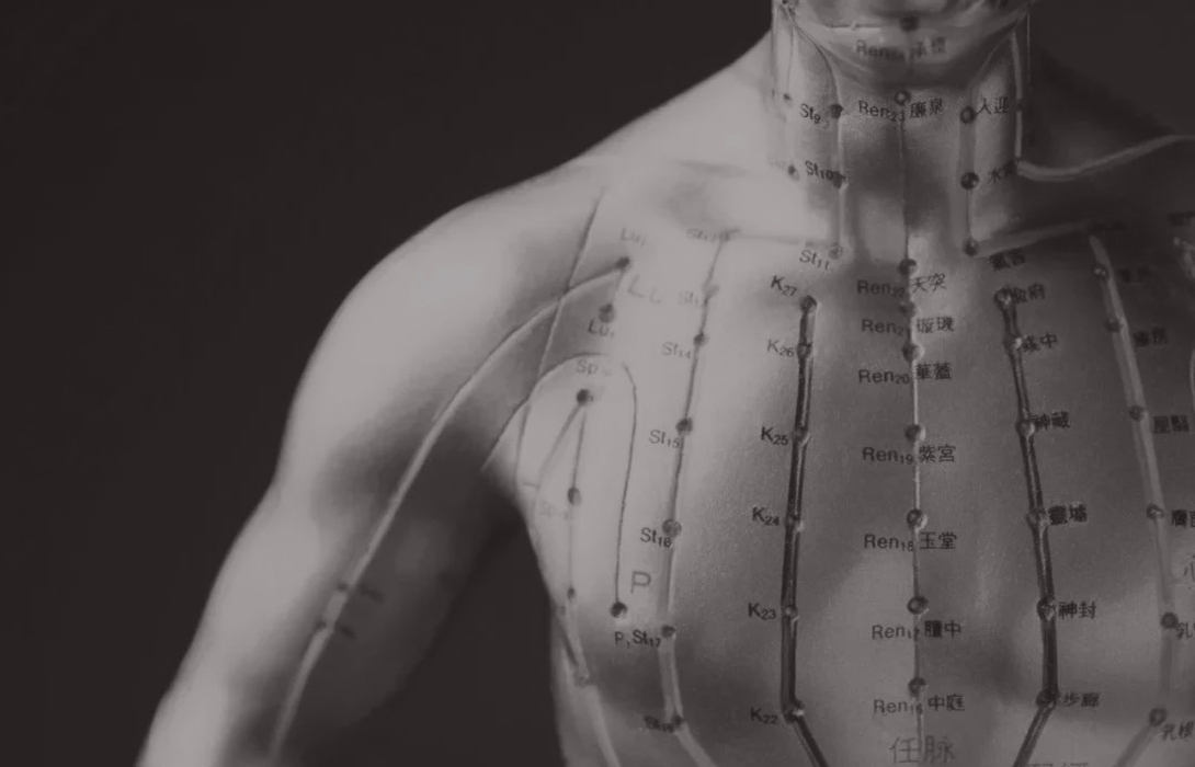 acupuncture7