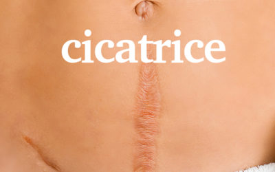 Cicatrice avec La fascia thérapie acupuncture