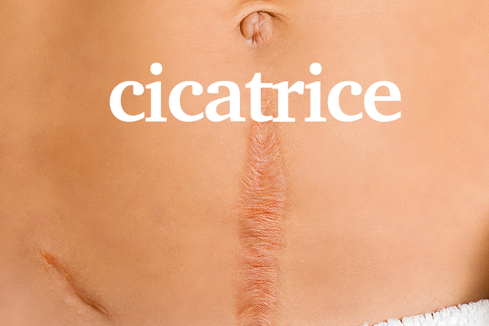 Cicatrice avec La fascia thérapie acupuncture