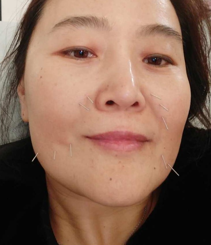 bien-être, médecines alternatives, Fascia Thérapie Acupuncture, Pharmacopée Chinoise, diététique chinoise, Aculifting.