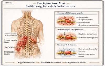 Soulager la douleur du zona : une approche par la régulation fasciale