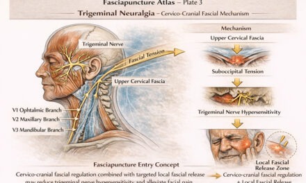 Névralgie du trijumeau : amélioration d’une douleur faciale chronique par régulation fasciale cervico-crânienne