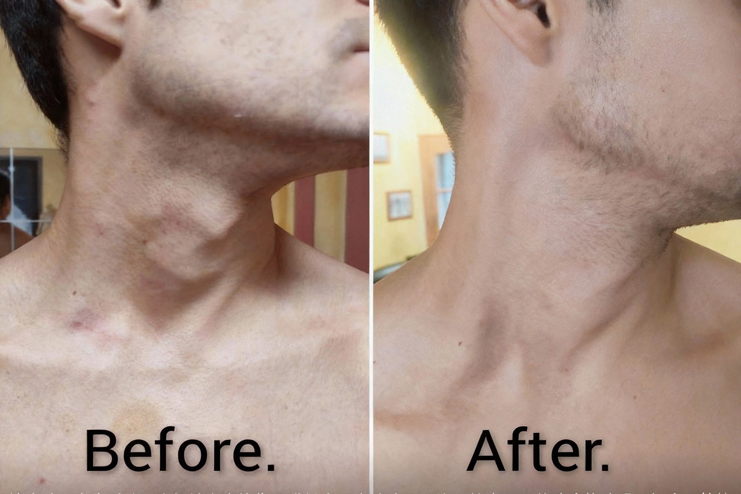 Une évolution inattendue de l’équilibre thyroïdien